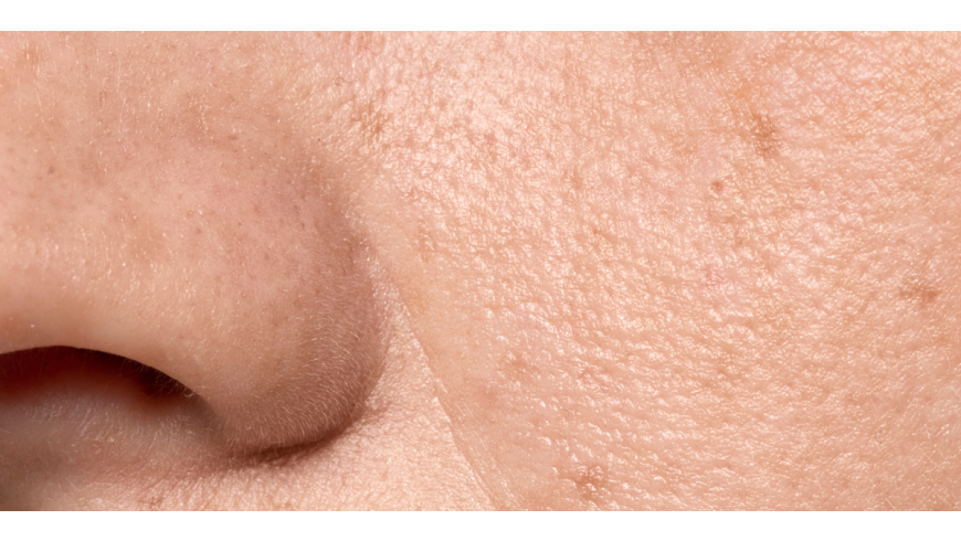Vitamina A i pell: diferències entre retinol, retinal i àcid retinoic