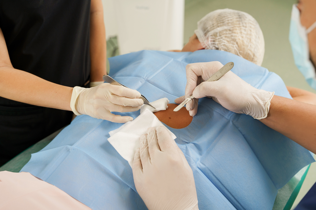CIRURGIA DERMATOLÒGICA