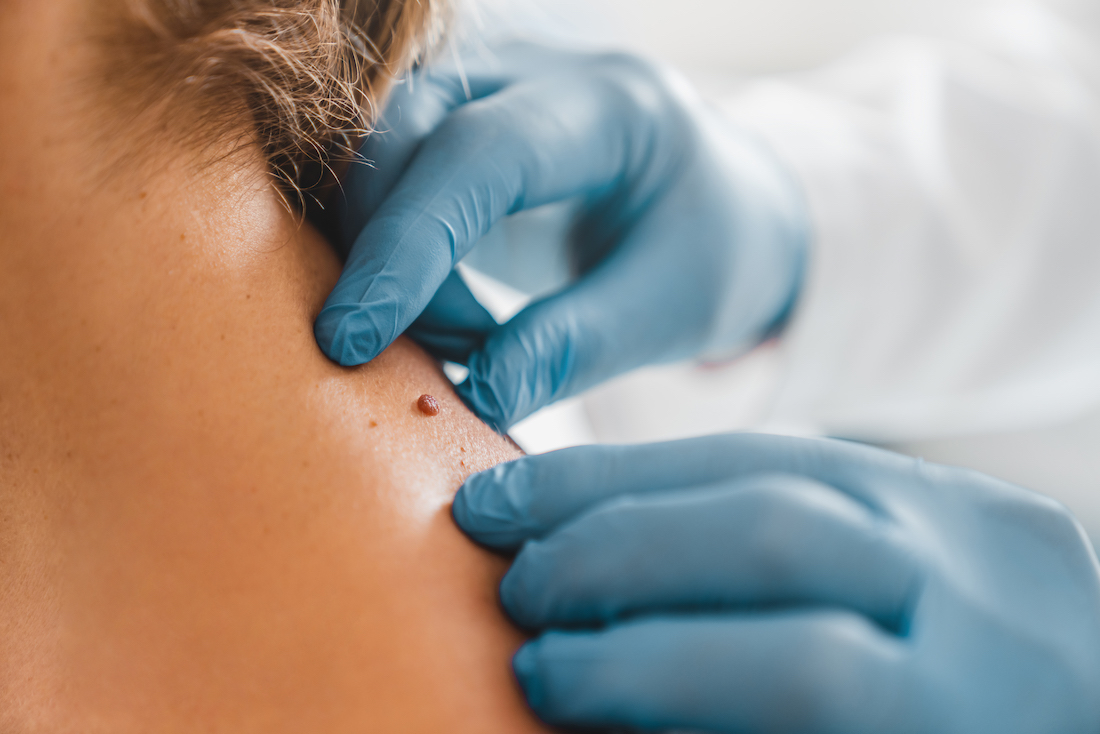 DERMATOLOGIA CLÍNICA